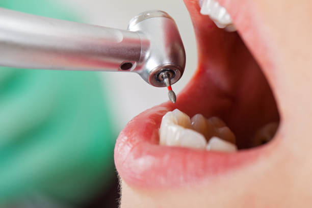 Best Emergency Treatment for Toothache in Higganum, CT
